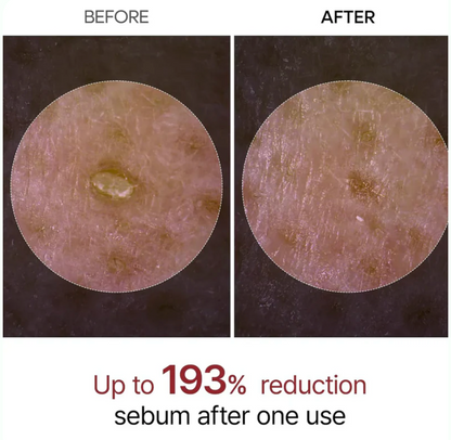 Dr. Melaxin Rice Peel Serum Ampoule™